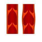 Thromboseprophylaxe: Definition, Entstehung & Maßnahmen