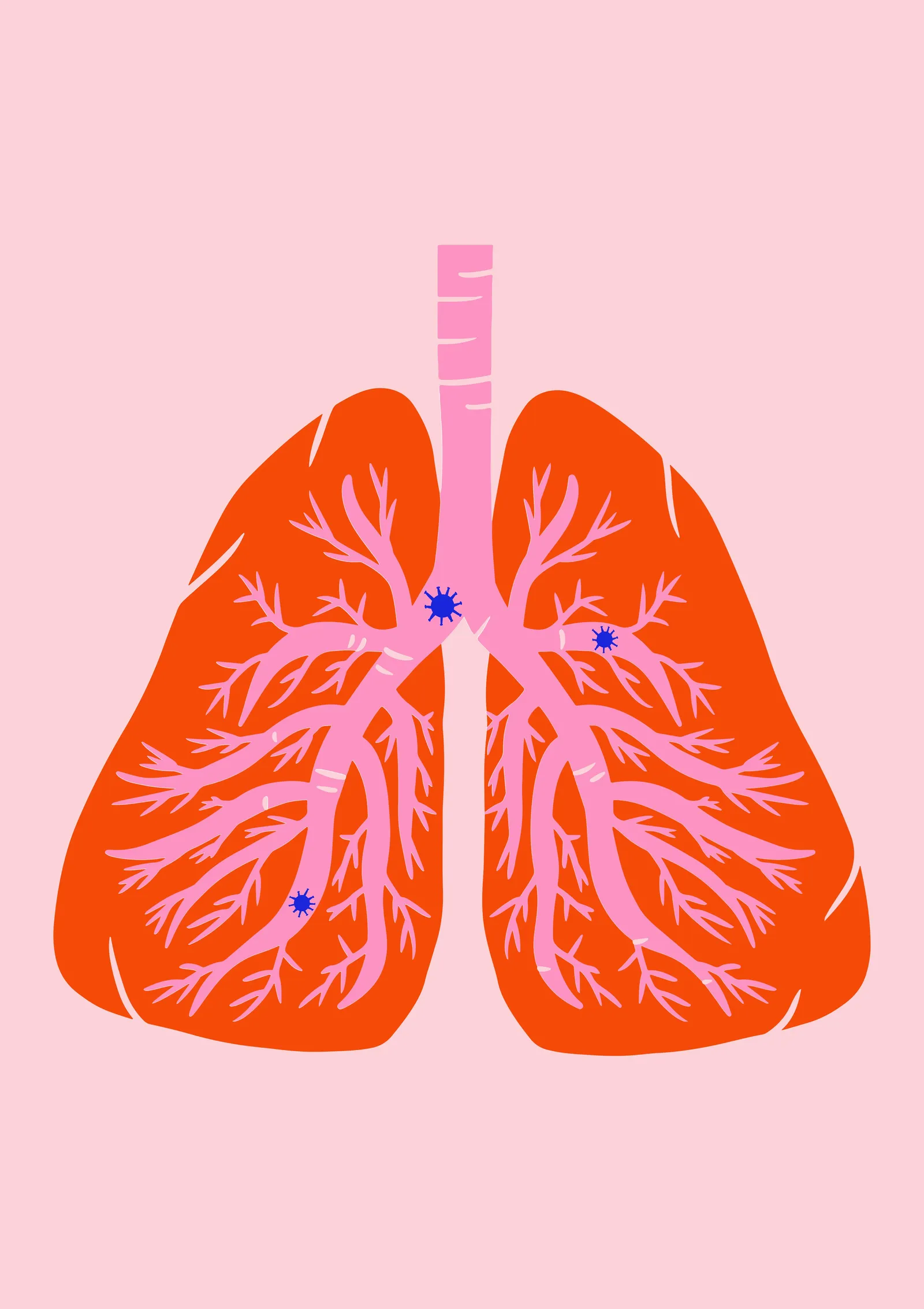 Pneumonieprophylaxe -Definition & Formen der Pneumonie sowie Maßnahmen zur Vorbeugung