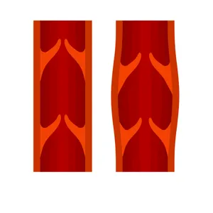 Thromboseprophylaxe: Definition, Entstehung & Maßnahmen