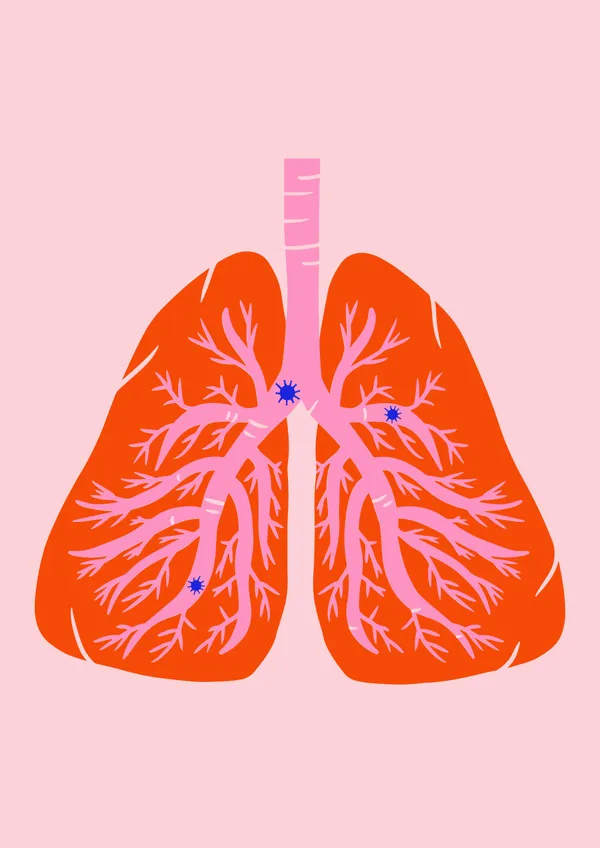 Pneumonieprophylaxe -Definition & Formen der Pneumonie sowie Maßnahmen zur Vorbeugung